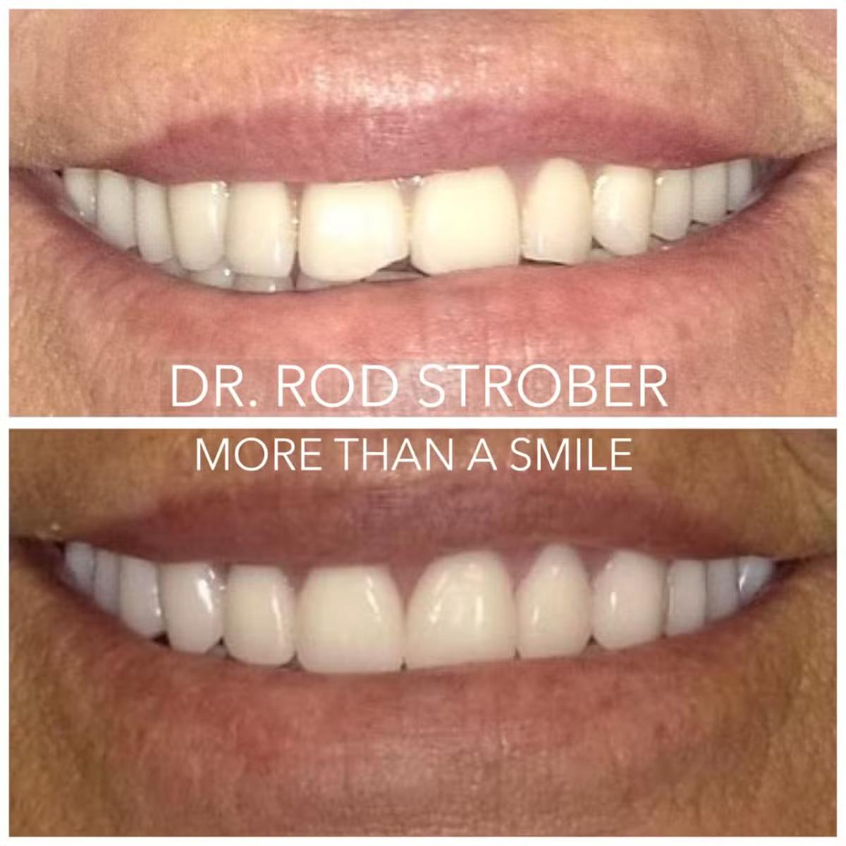 BioClear dental treatment case