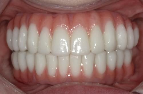 SHOFU DENTAL DIGITAL CAMERA