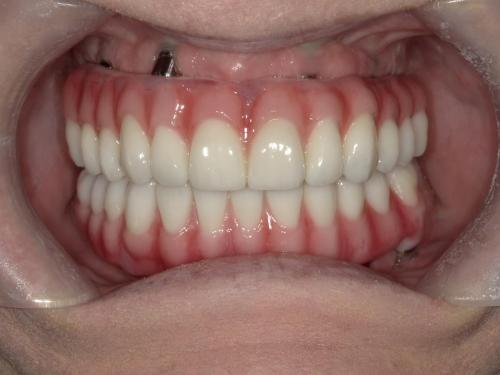 SHOFU DENTAL DIGITAL CAMERA