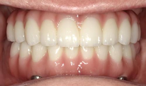 SHOFU DENTAL DIGITAL CAMERA
