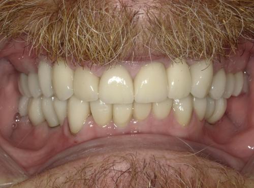 SHOFU DENTAL DIGITAL CAMERA